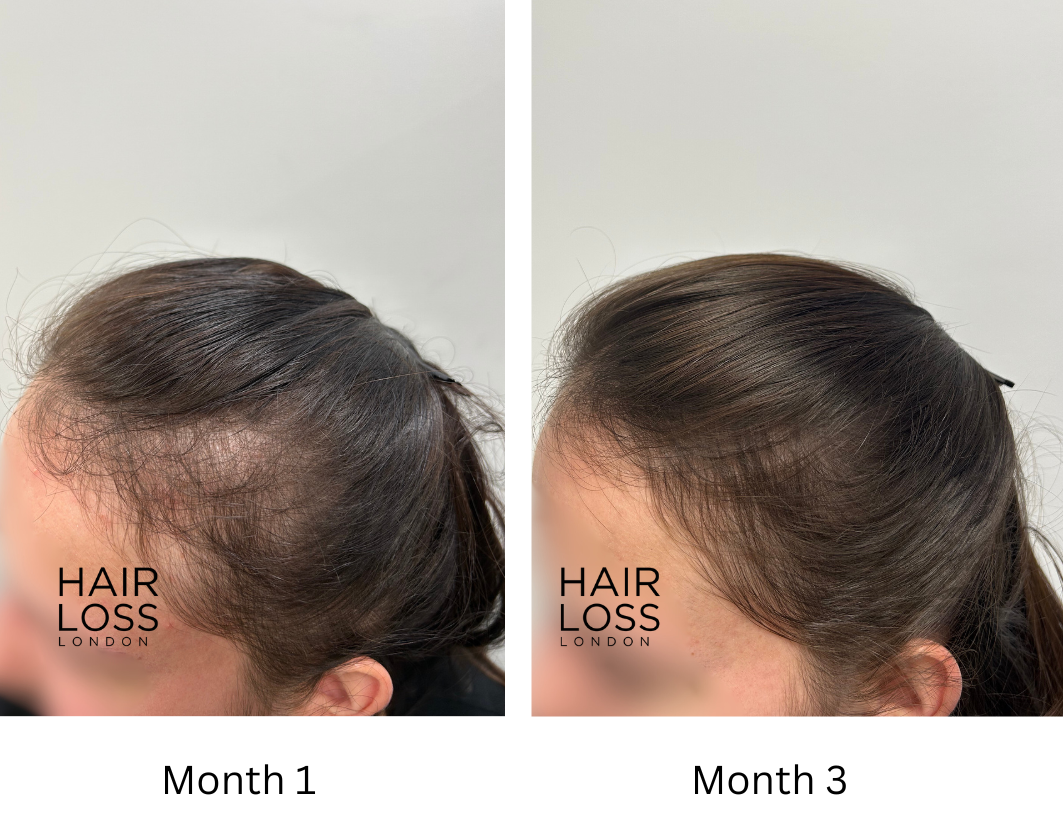 Different hair types