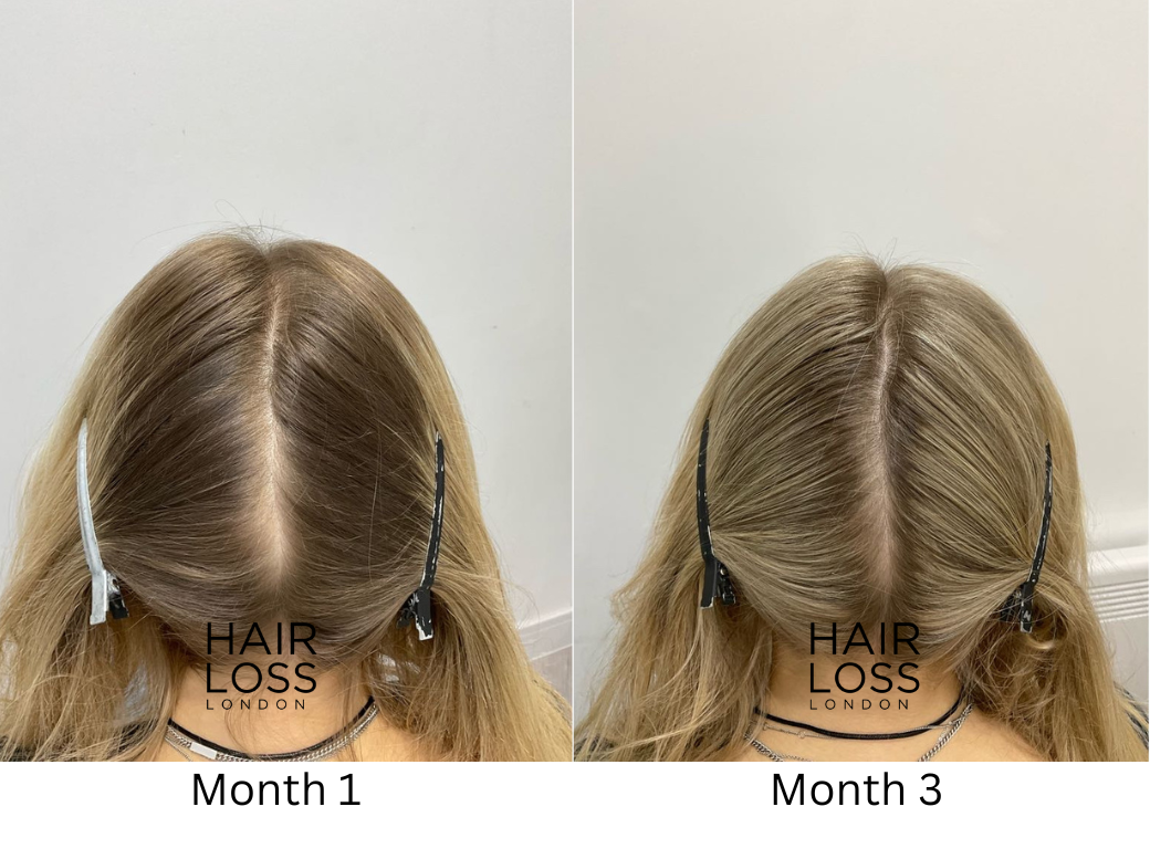 Jennifer Aniston hair